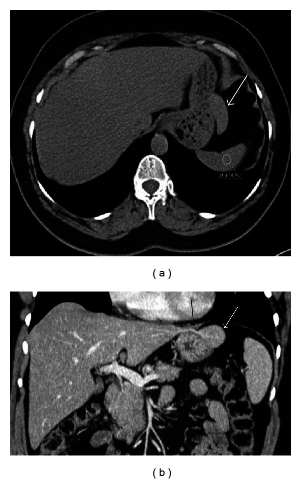 Figure 13