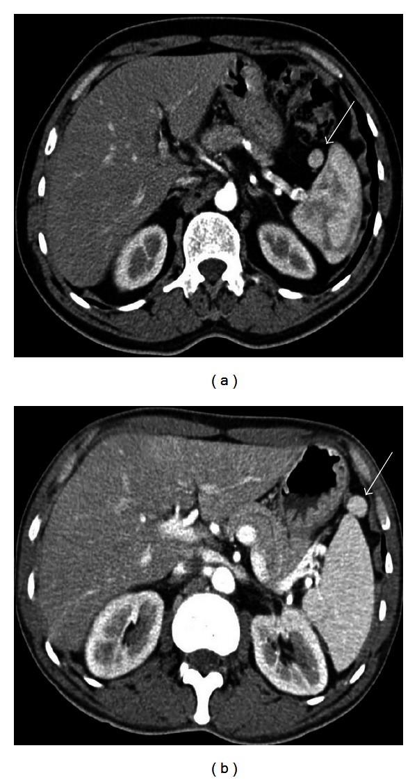 Figure 14