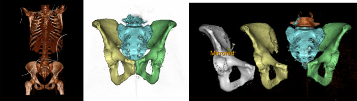 Figure 1: