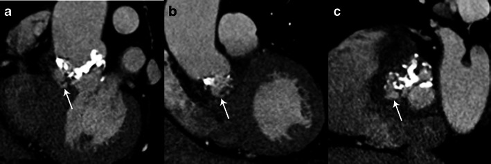 Fig. 5