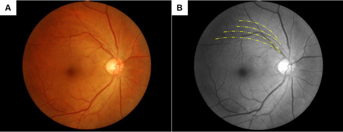 Fig 1