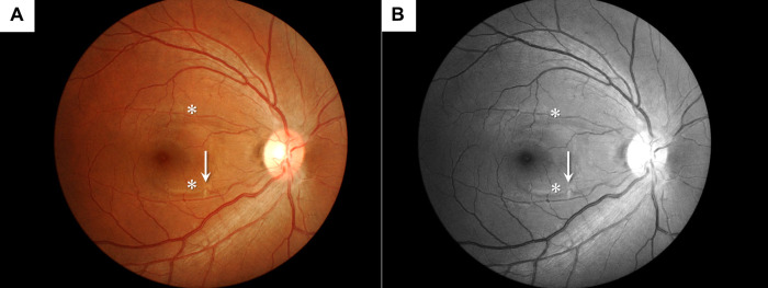 Fig 2