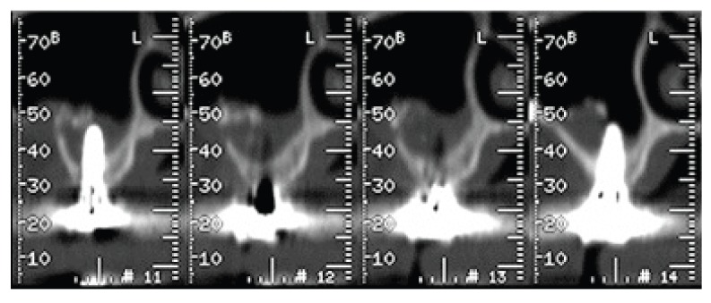 Figure 10