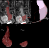 Fig. 2