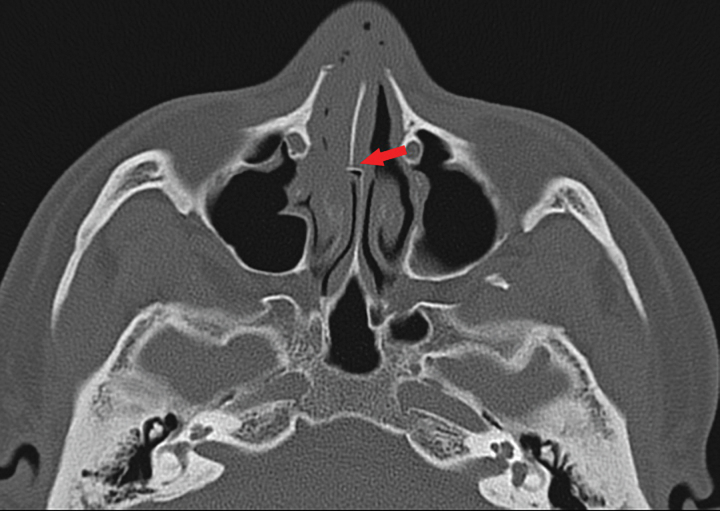 Fig. 3.