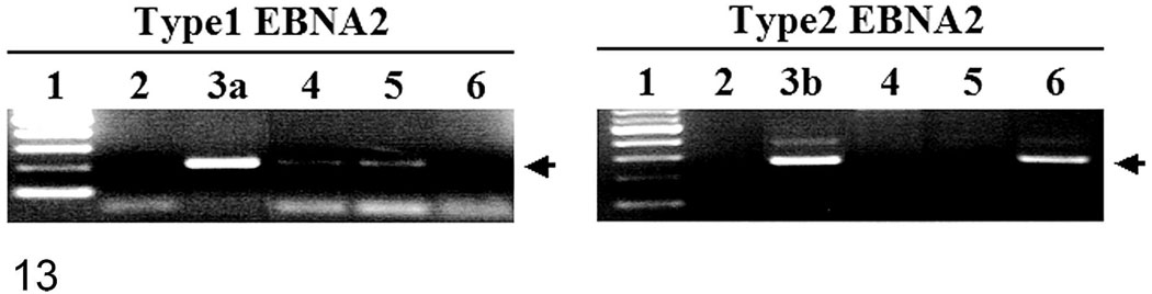 Fig. 13