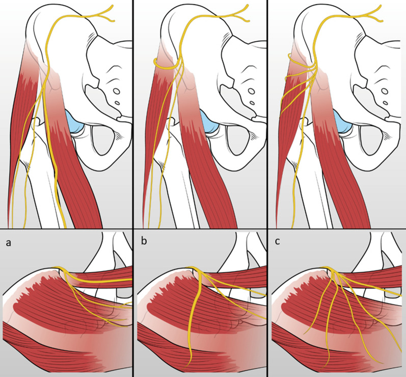 Fig. 3
