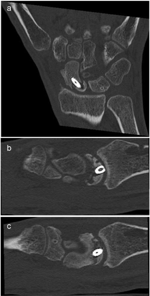 Figure 2.