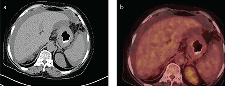 Figure 1. a, b