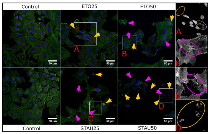 Figure 16