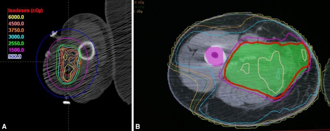 Fig. 2A–B