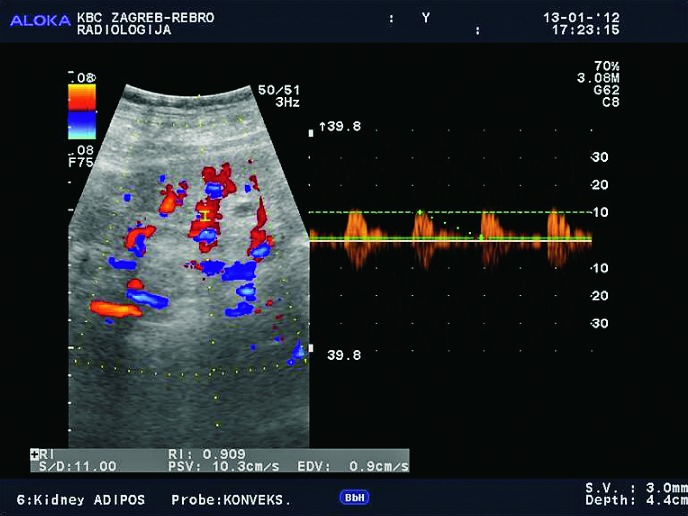 Fig. 43c