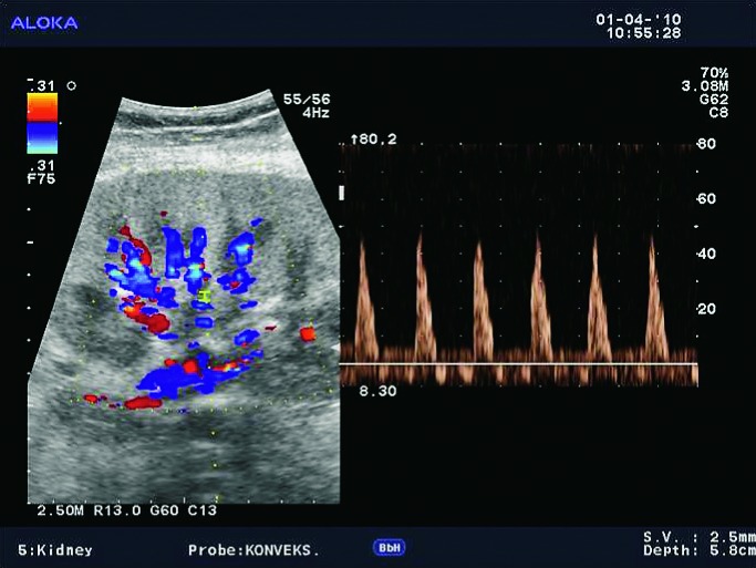 Fig. 41b