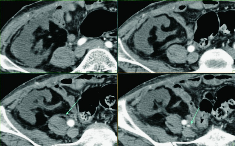 Fig. 24