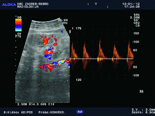 Fig. 43d