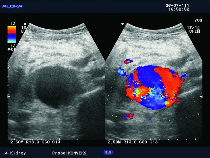 Fig. 13