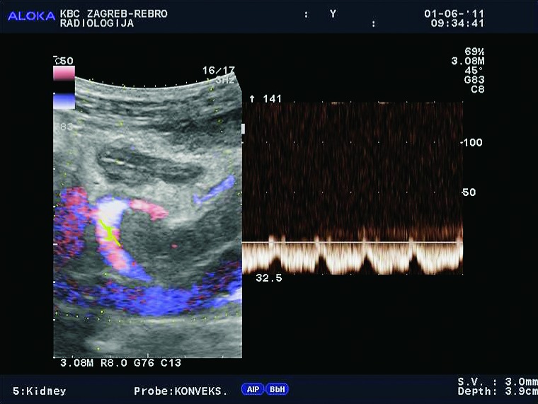 Fig. 3b