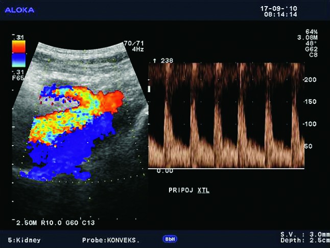 Fig. 3a