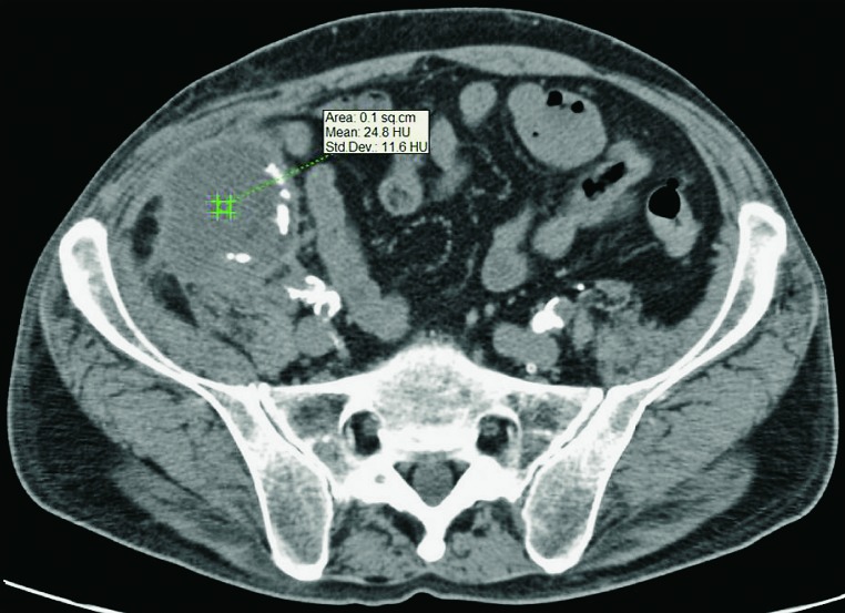 Fig. 15