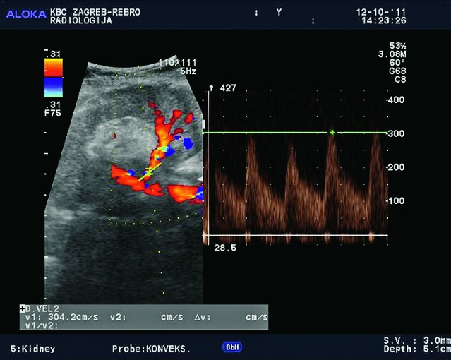 Fig. 31