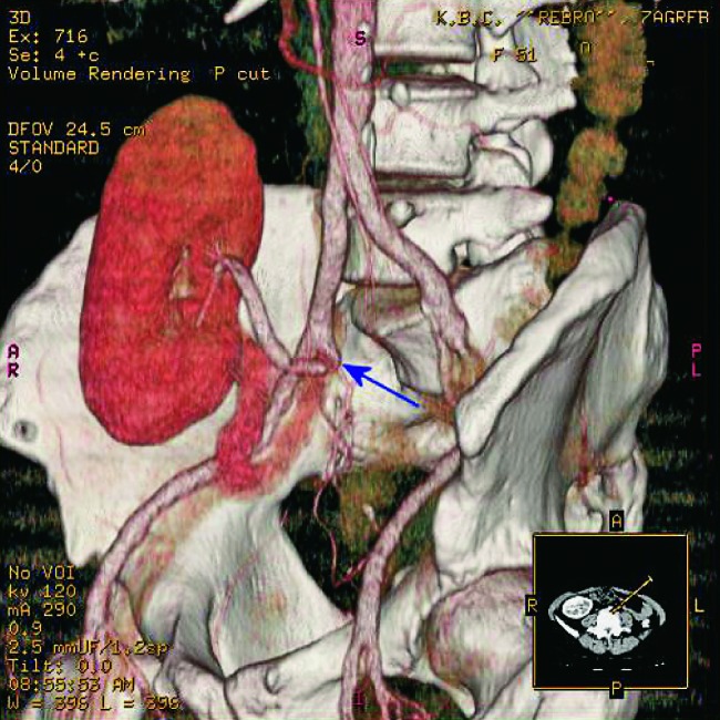 Fig. 33