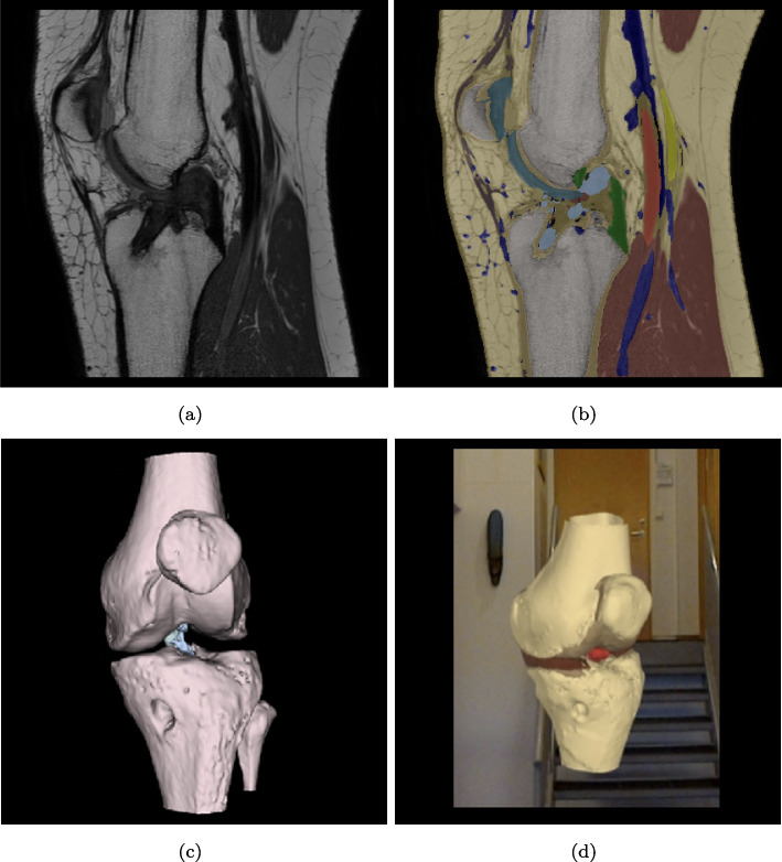 Fig. 5