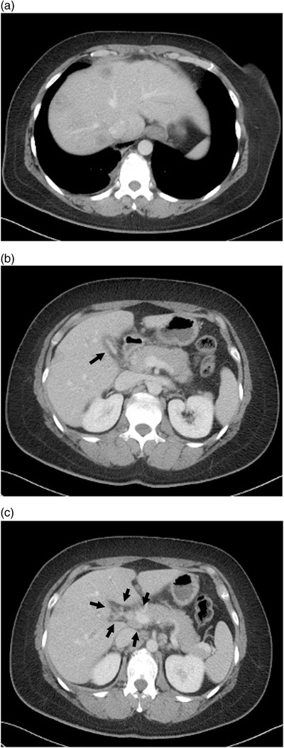 FIGURE 1