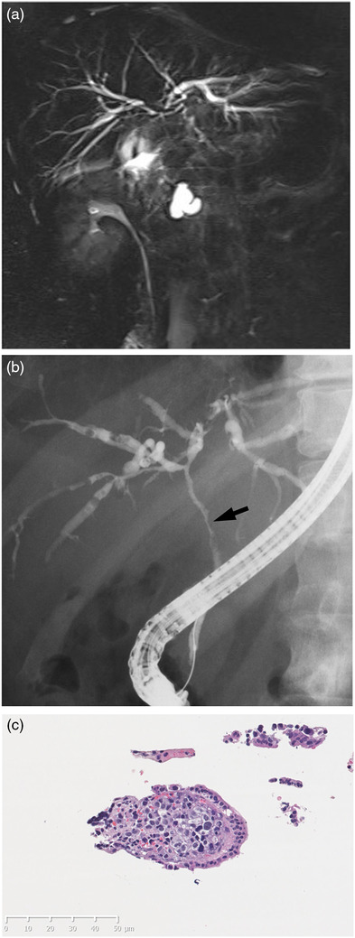 FIGURE 2