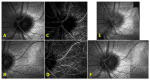 Fig. 11