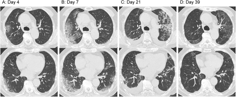 Fig. 2