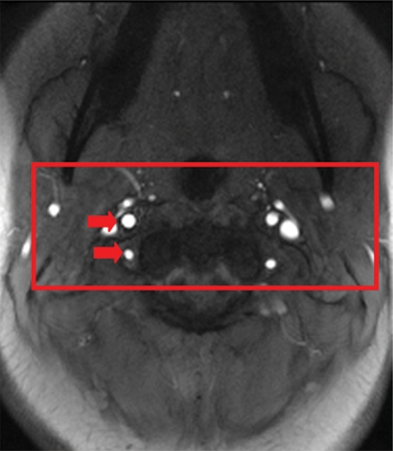 Figure 1a: