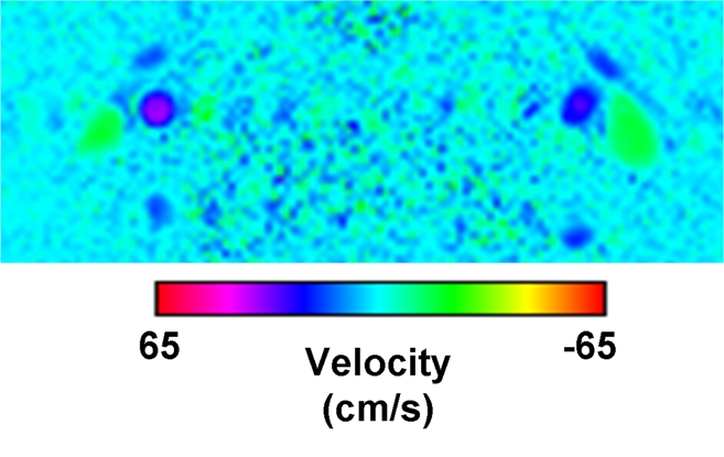 Figure 1b: