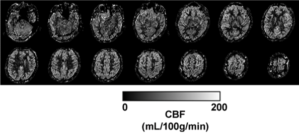 Figure 1c: