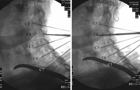 Fig. 3