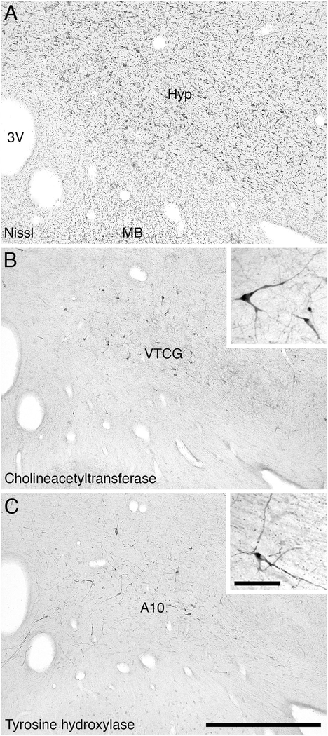 Figure 11.