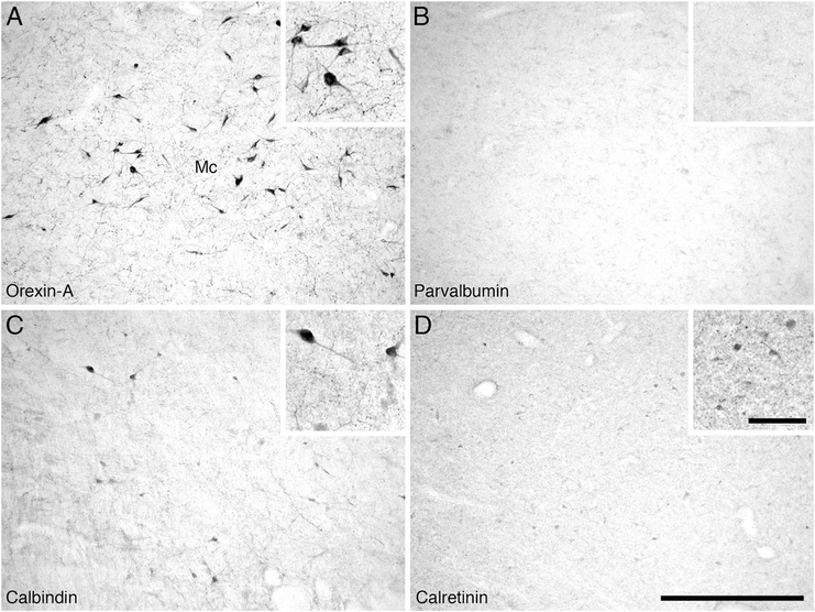 Figure 14.