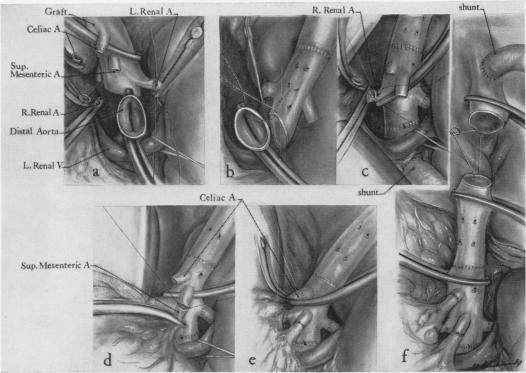 Fig. 12.