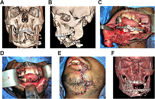 Figure 6.