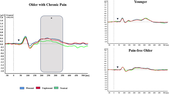 FIGURE 3