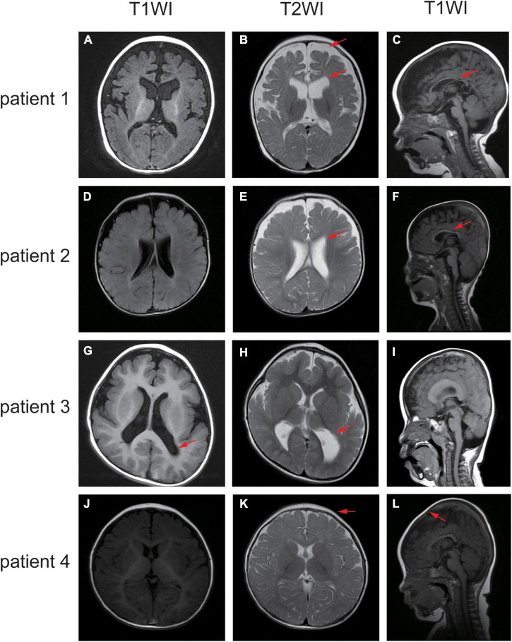 FIGURE 3