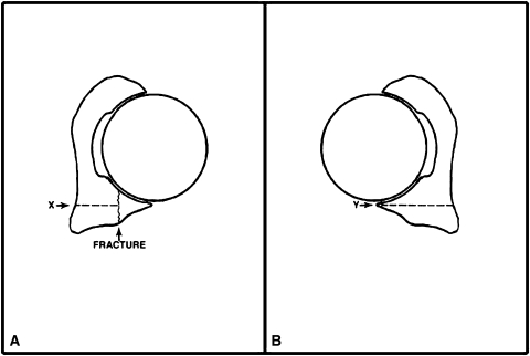 Fig. 2A–B