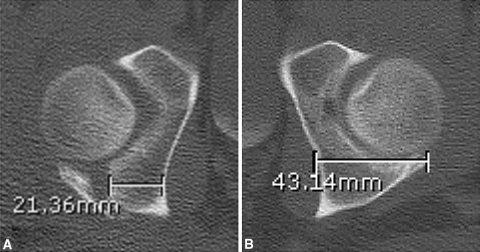 Fig. 3A–B