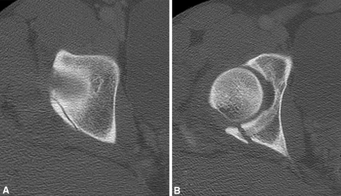 Fig. 1A–B