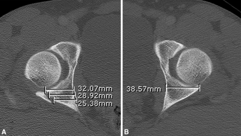 Fig. 4A–B