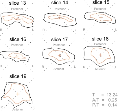 Figure 16