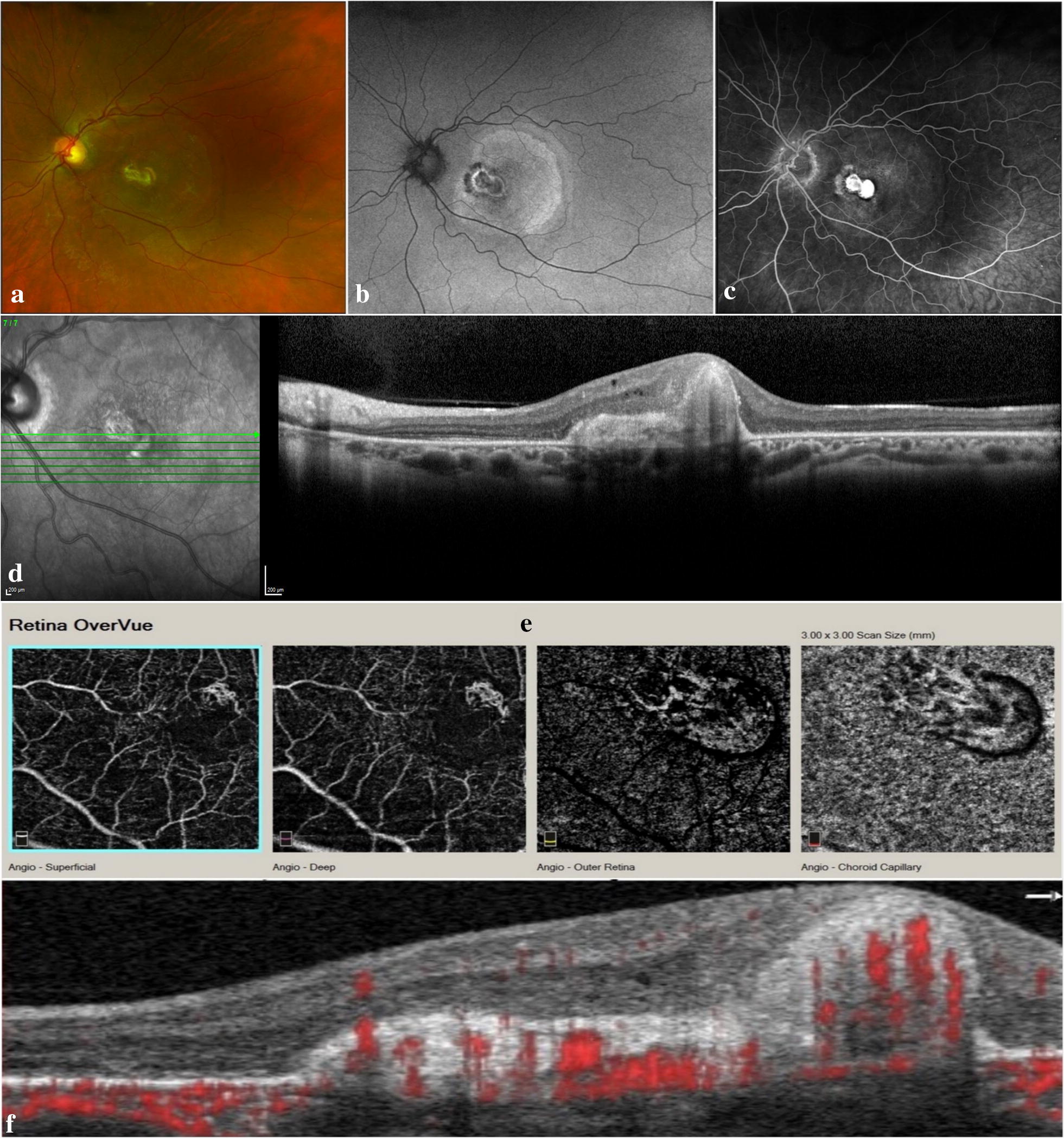 Fig. 2
