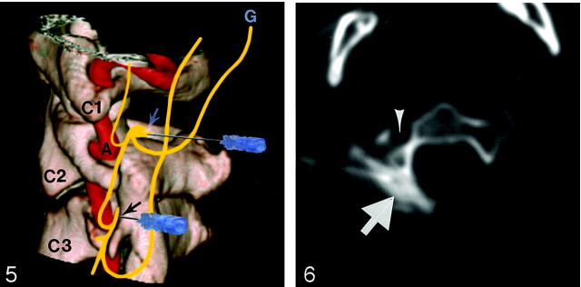 Fig 5.