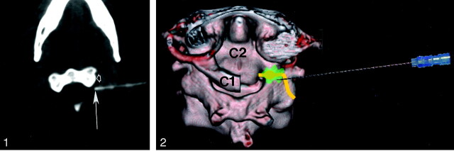 Fig 1.