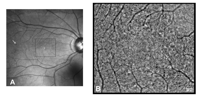 Fig 1