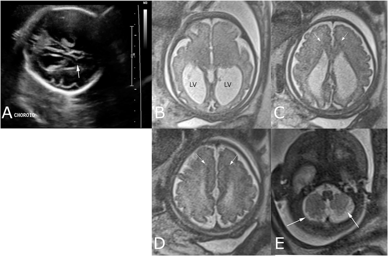 FIG. 1.